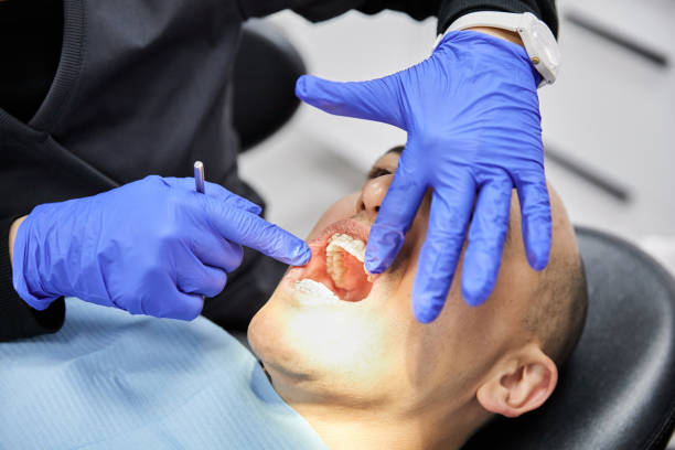 Best Emergency Dentist for Lost Fillings or Crowns in Gallipolis, OH